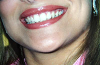 &lsquo;&lsquo;Turismo dentale&rsquo;&rsquo; in crescita