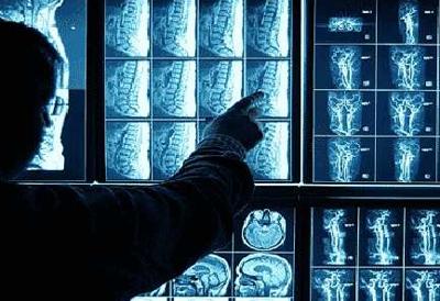 Ipercolesterolemia, un miliardo l&rsquo;anno di costi diretti