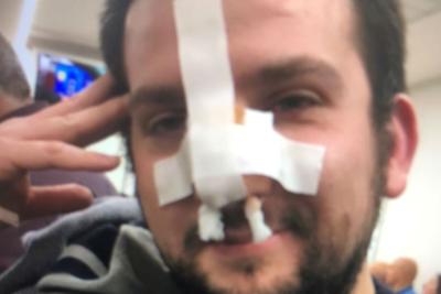 Cronista pestato a sangue in pieno centro