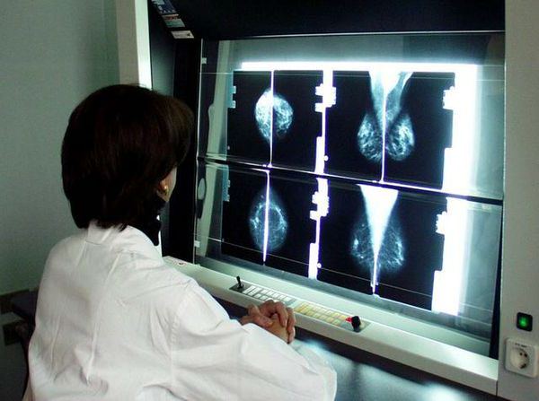 Prevenzione o terrorismo?