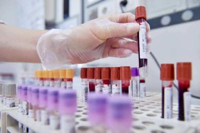 A Milano i 'top 40' dell'ematologia: "Ecco la road map per battere i tumori del sangue"