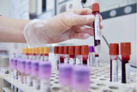 In Italia l&rsquo;anticorpo sottocute contro l&rsquo;emofilia