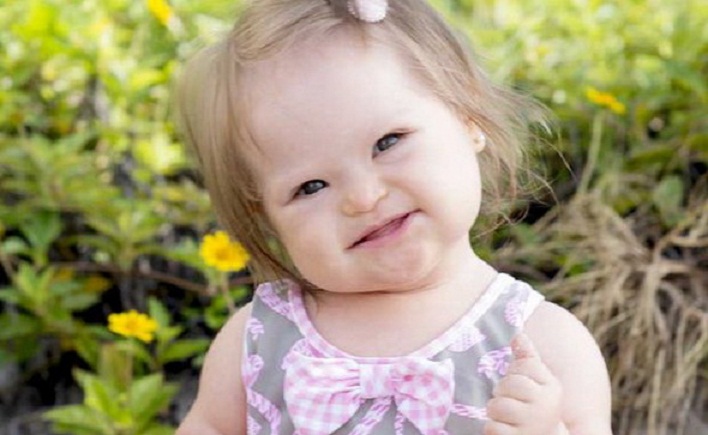 Bimbi Down a rischio &lsquo;&lsquo;estinzione&rsquo;&rsquo;