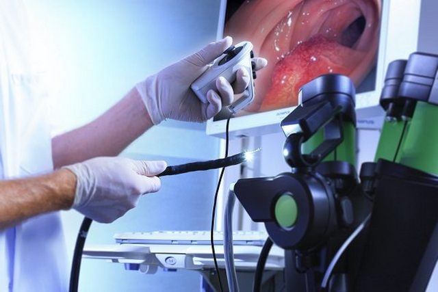 Endoscopia, la Asl Roma 4  riorganizza le prestazioni