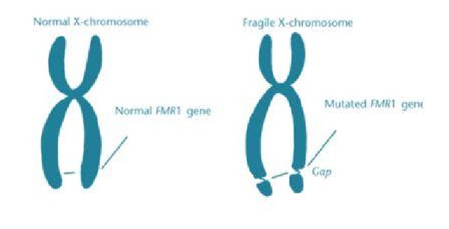 Malattie rare, con l&rsquo;X fragile parte il ciclo di incontri formativi