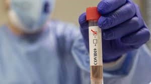 Sanità Lazio, Fp Cgil: “Bene i tamponi rapidi, si parta da tutto il personale sanitario e socio sanitario”