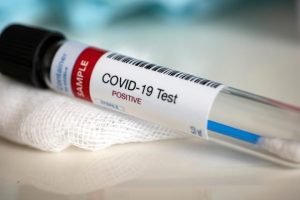 Coronavirus, a Ladispoli 147 casi
