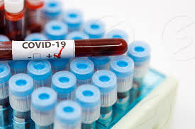 Coronavirus, 65 nuovi casi nella Tuscia: uno a Tarquinia