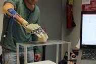 Miracolo a Sezze, perde mani e piedi per la meningite: lancia una raccolta fondi e arrivano 60mila euro per le protesi bioniche