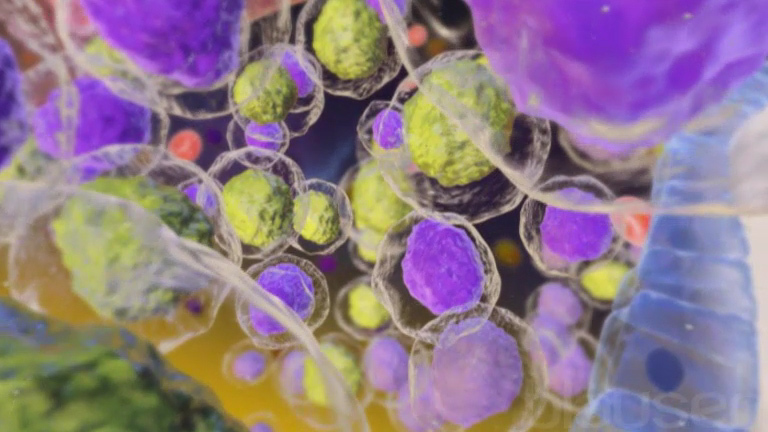 ARRIVA IN ITALIA UN NUOVO FARMACO CONTRO LA LEUCEMIA MIELOIDE CRONICA