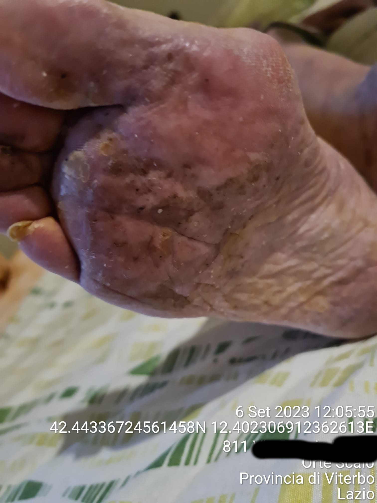 Orte – Anziana abbandonata sola in casa trovata tra escrementi e sporcizia