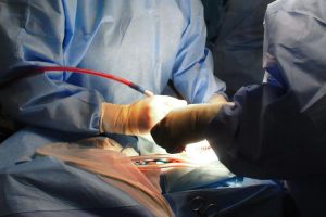 Chirurgia d’eccellenza a Civitavecchia, al San Paolo impiantato neurostimolatore midollare su paziente cardiopatica
