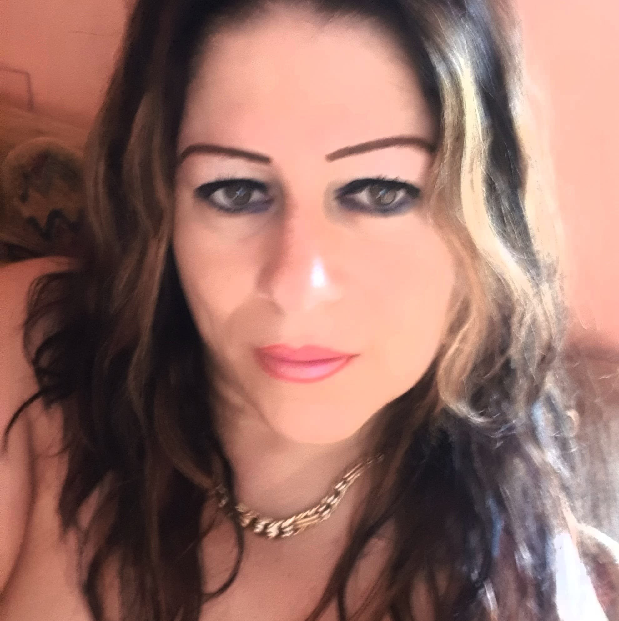 Quattro arti per Carmen: raccolta fondi per ridare braccia e gambe alla giovane di San Lorenzo Nuovo