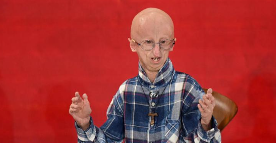 Sammy Basso beato, il vescovo di Vicenza si dice favorevole