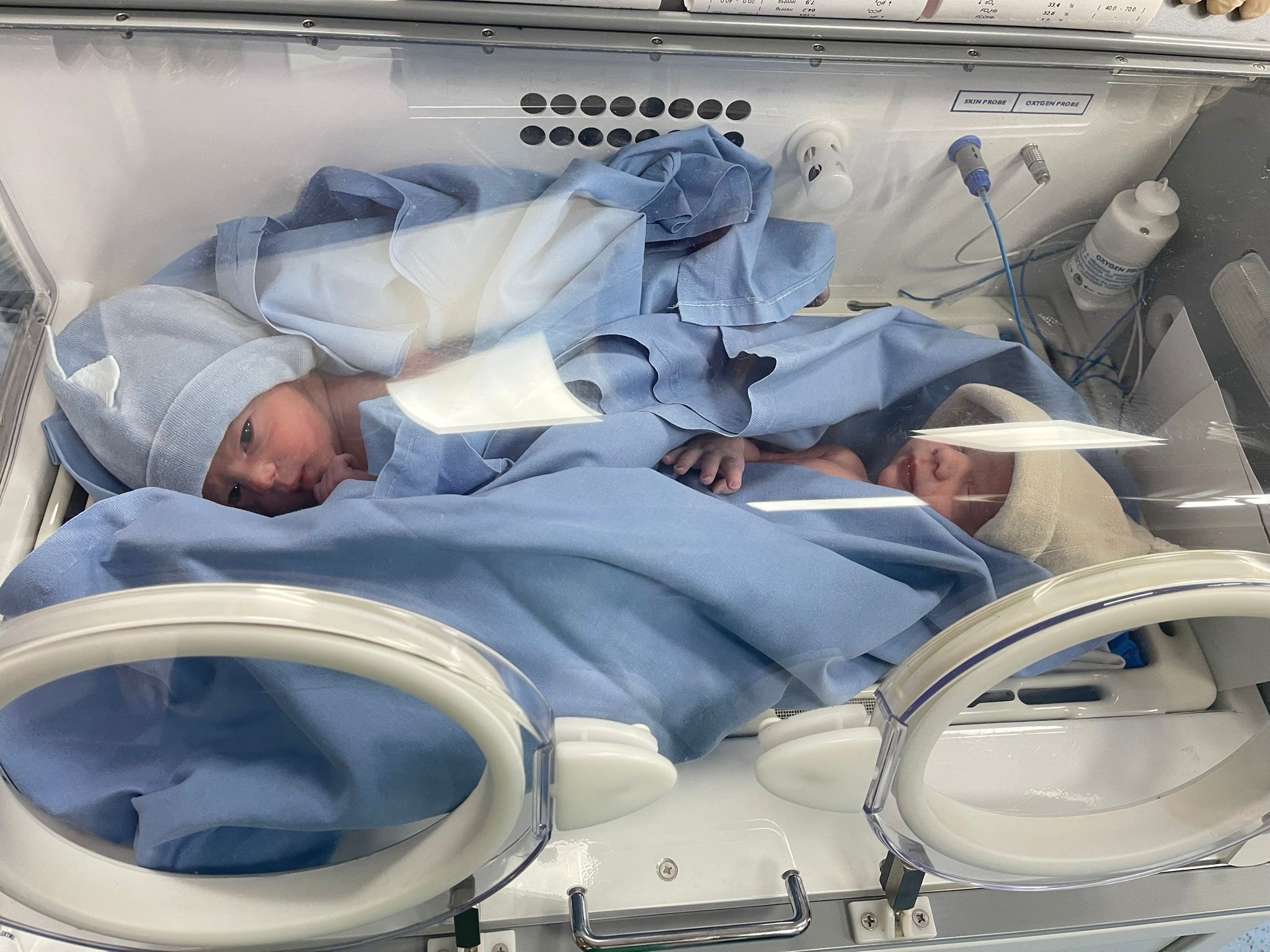 Civitavecchia – Parto gemellare spontaneo alla 36esima settimana: “Evento raro gestito ottimamente”