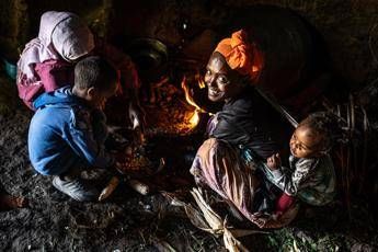 La storia di Fatuma, mamma 30enne di 4 figli, salvata in Etiopia dalla cecità per tracoma