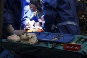 Trapianti, a Pisa evento mondiale, prime linee guida sicurezza donatore vivente di rene