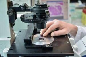 Tumori al seno, anticorpo coniugato in prima linea rallenta la malattia