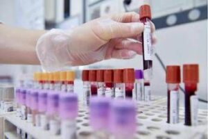 Sibioc, su ipotesi Regione Lazio: “No esternalizzazione medicina di laboratorio”