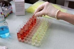 Svolta nella produzione di sangue artificiale, un ‘segnale’ può farla decollare