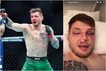 Vettori, ritorno amaro. Perde con Allen e mostra naso rotto e lividi in faccia