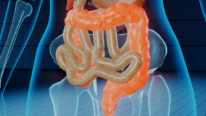 Colite ulcerosa, autorizzata la rimborsabilità per etrasimod