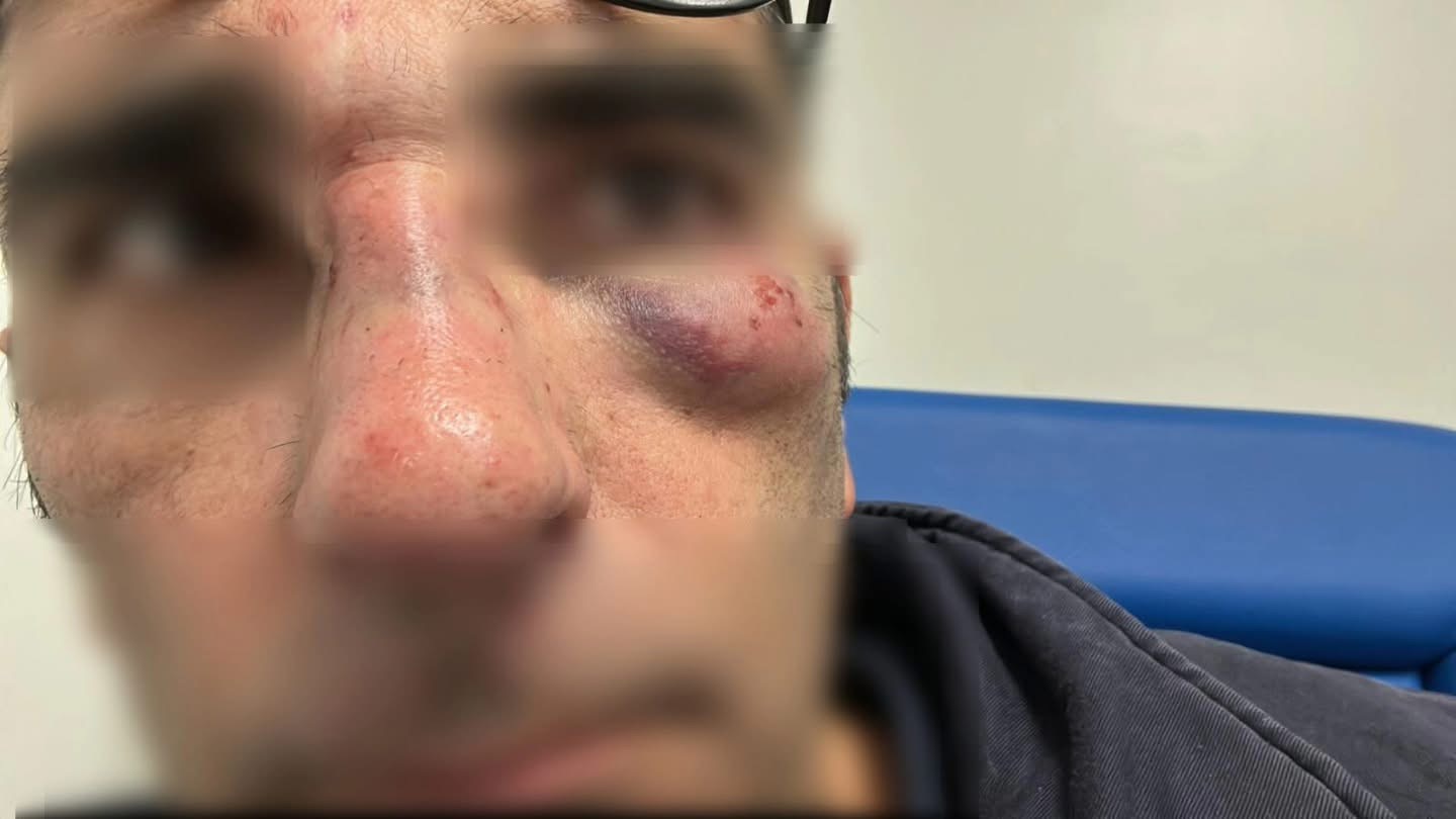 Anagni – Controllore Co.Tra.L. aggredito sull’autobus mentre svolgeva il suo lavoro