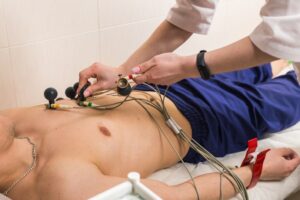 Elettrocardiogramma, holter cardiaco e holter provvisorio: da oggi disponibili anche in farmacia