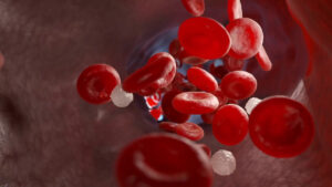 EGPA, un Libro Bianco dà voce ai pazienti e chiama le istituzioni all’azione