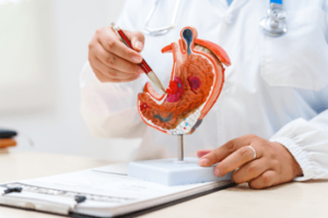 Tumore allo stomaco, pazienti: “Diagnosi precoce per meno di 1 su 5, migliorare percorsi”