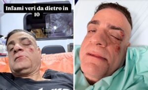 Roma – Aggredito in metro dal branco lo youtuber Cicalone: “Accerchiato, poi pugni e calci alla testa e sono svenuto”