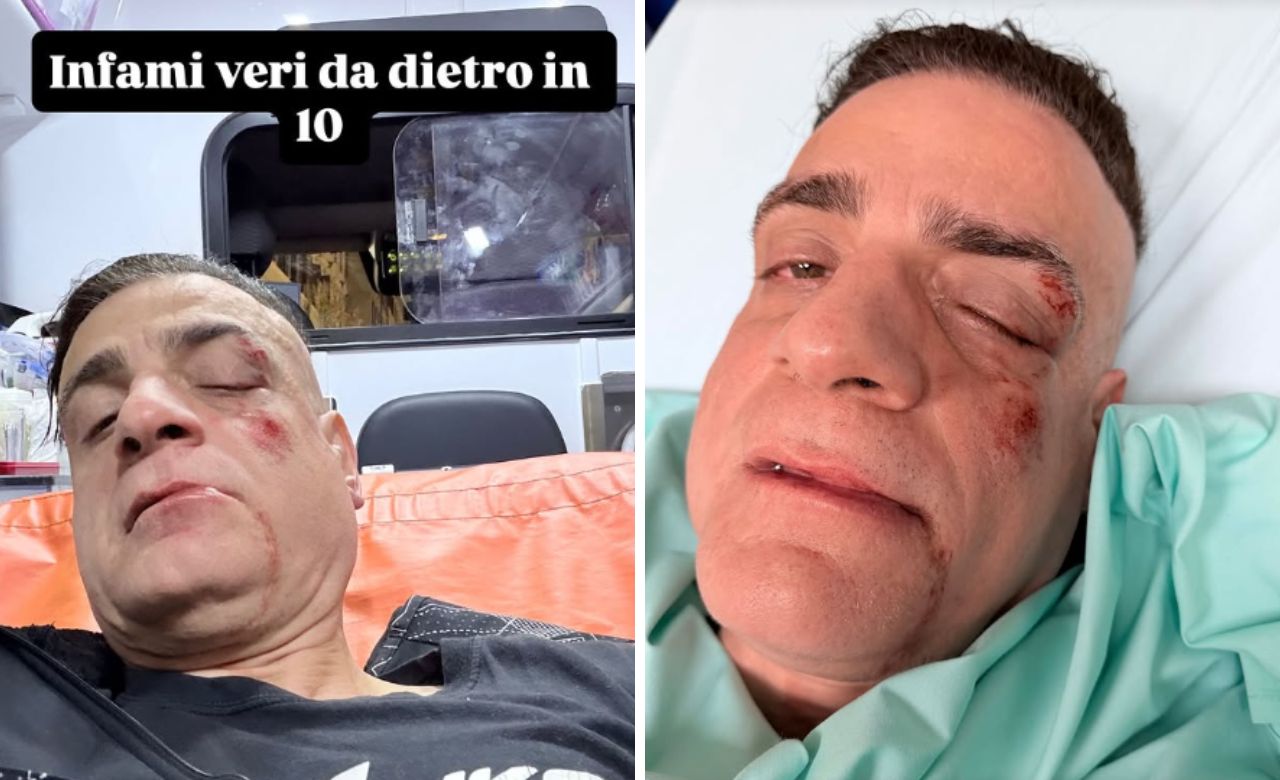 Roma – Aggredito in metro dal branco lo youtuber Cicalone: “Accerchiato, poi pugni e calci alla testa e sono svenuto”