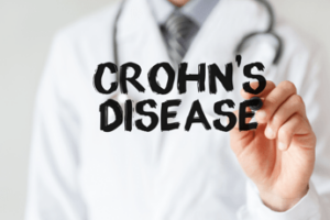 Medicina: malattia di Crohn, nutrizione clinica in corsi regionali Ig-Ibd per gastroenterologi