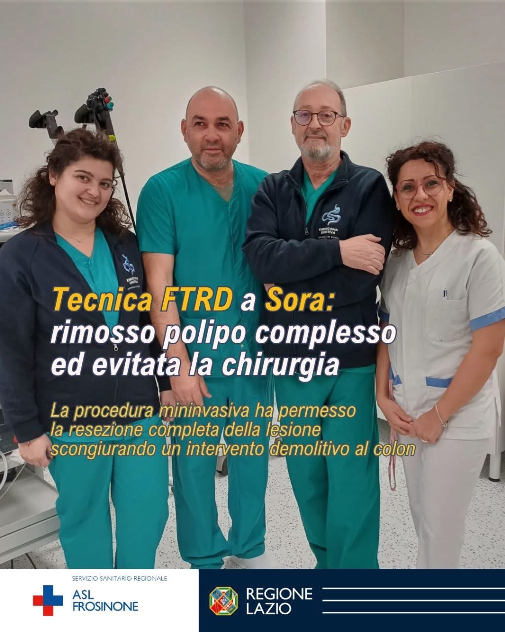 Sanità: Asl Frosinone, a Sora asportato polipo colon con tecnica mininvasiva