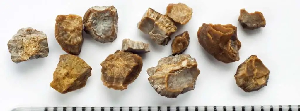 Rubano calcoli renali credendoli “pepite” in casa dell’ex direttore del Messaggero Veneto