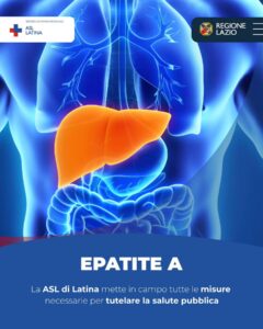 Venticinque casi di epatite A a Latina: attivata task force per il contenimento del contagio