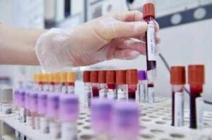 Allarme oncologi: “- 50% trial in Europa in 10 anni mentre Cina accelera”