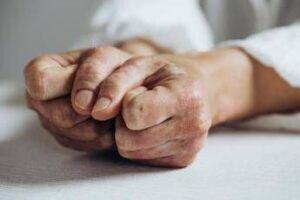 Open day psoriasi, l’11 marzo visite gratis in 90 ospedali Bollino rosa