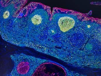 Irccs Pascale Napoli, ‘mappa Gps’ delle cellule rivoluziona l’immunoterapia