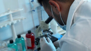 Un “interruttore” molecolare frena la progressione del cancro