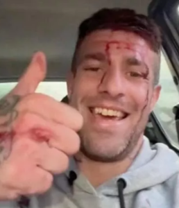 Gambizzato Damiano Sartori, il tiktoker che aggredì una carabiniera alla Sagra della Castagna di Soriano