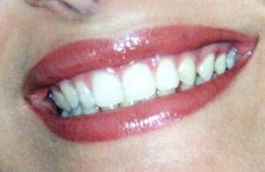 Dentista senza prenotazione a Roma, all’Isola Tiberina visite immediate per urgenze e controlli
