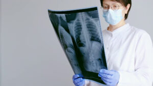Il Covid ha cambiato percezione malattie respiratorie, nuova attenzione a rischi