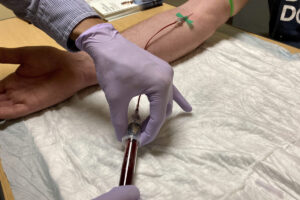 Tumore del sangue, nasce ProgEvo: il modello che ricostruisce la storia genetica per aiutare medici e pazienti
