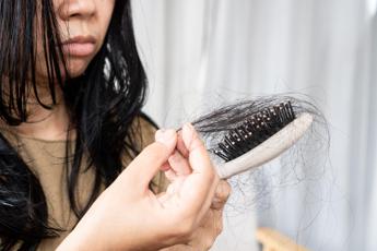 Con nuovi farmaci anti diabete e obesità più rischi di perdere i capelli, lo studio
