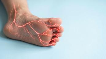 Asl Roma 4, presentato nuovo Pdta per neuropatia diabetica dolorosa