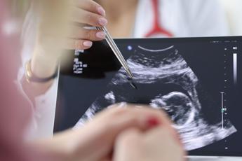 Chirurgia, si rompe l’aorta e viene operata con il bimbo in utero, intervento record a Milano