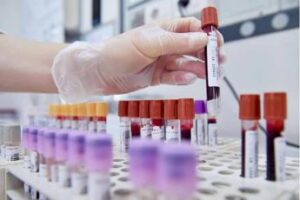 Hiv, dalla Sicilia il modello per estendere terapie long acting