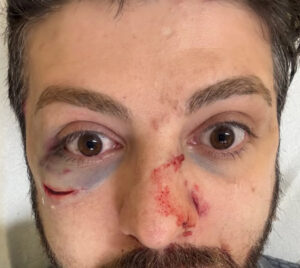 L’influencer “Guardian of Rome” picchiato dopo aver salvato una turista da truffa, divieto di dimora per tre uomini