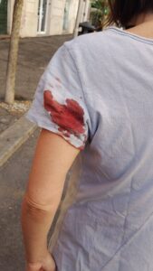 Roma – Passeggia in via della Giuliana e le sparano, Cristina Stillitano ferita da un proiettile vagante nei pressi del Vaticano